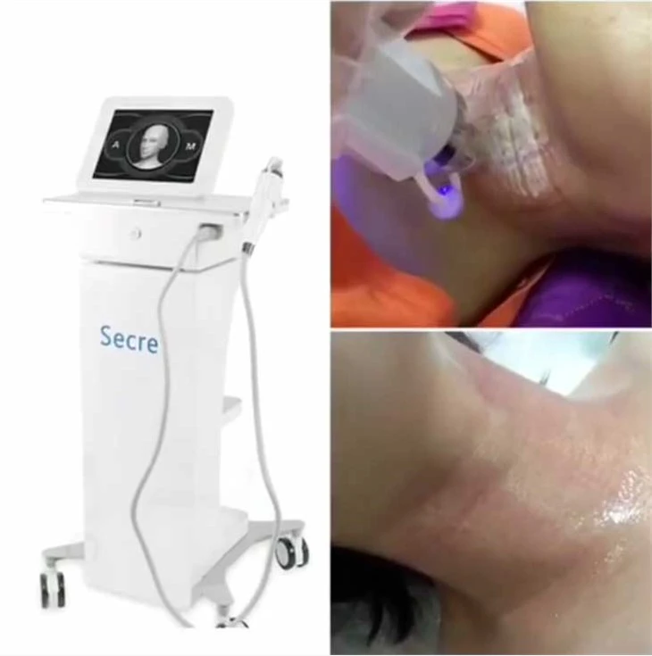 Xov tooj cua zaus Microneedling tshuab
