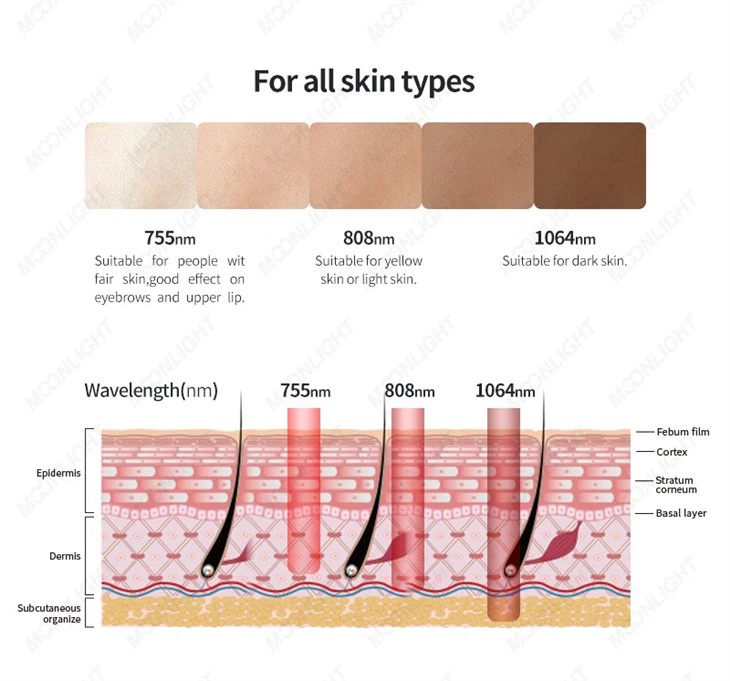 Alma Laser Soprano Titanium