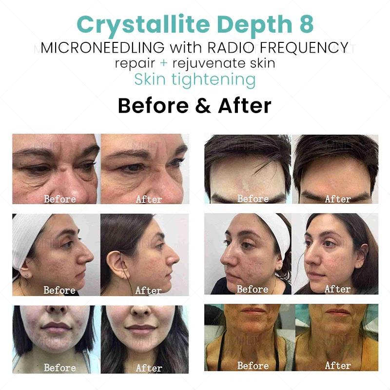 Portable Crystallite Depth 8 Morphues 8 Machine