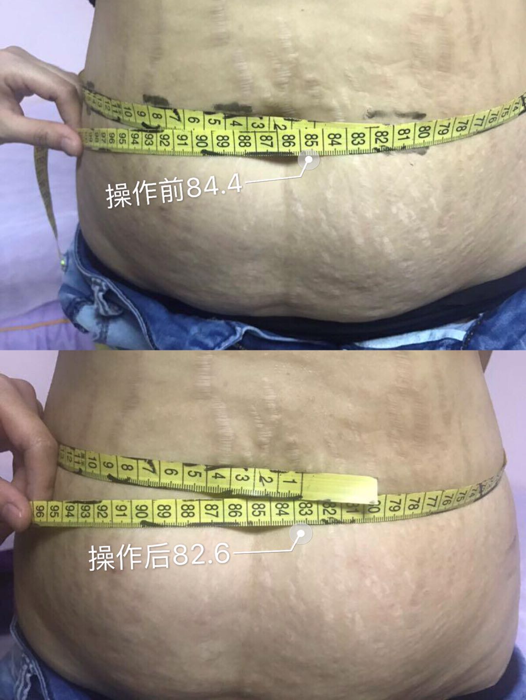 before and after 6