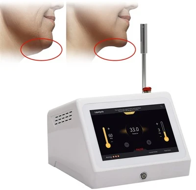 Kev Kho Mob Fat Melting 3D Lipolysis Liposuction 1470nm 980nm Diode Laser Endolaser Tshuab